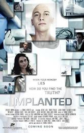 Implanted poster