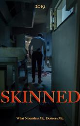 Skinned poster